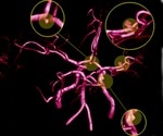 Investigating a Neuroprotective Pentapeptide in a Murine Model of Intracerebral Hemorrhage