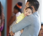 Microcephaly Epidemiology