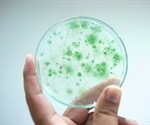 Microcystins in drinking water