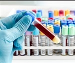 Applying a Proteomics-based Approach to the Clinic