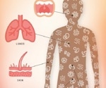 What is metatranscriptomics?​
