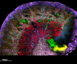 When cancer research turns to the immune system – the critical role of peptides and immunopeptidomics